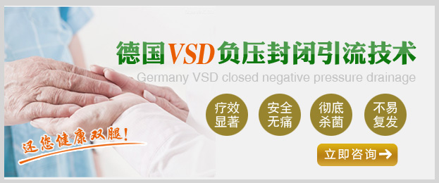 昆明治疗静脉曲张哪家医院好