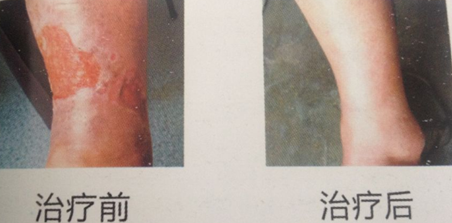 昆明三一一医院