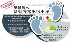 糖尿病足患者饮食需要注意什么