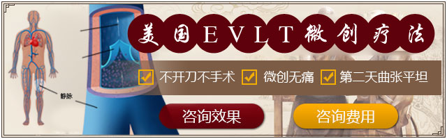 美国EVLT微创疗法