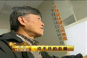 动脉硬化症患者